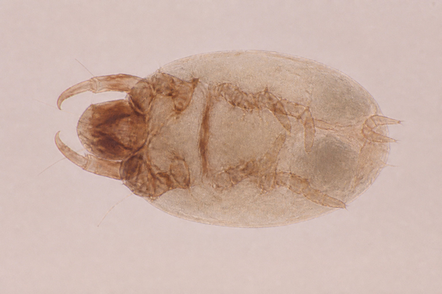 Parasites et champignons responsables de la dépilation